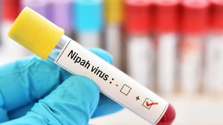 Pakistan Imposes Strict Health Screenings at Borders Following Nipah Cases in India
